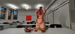 organ transplant